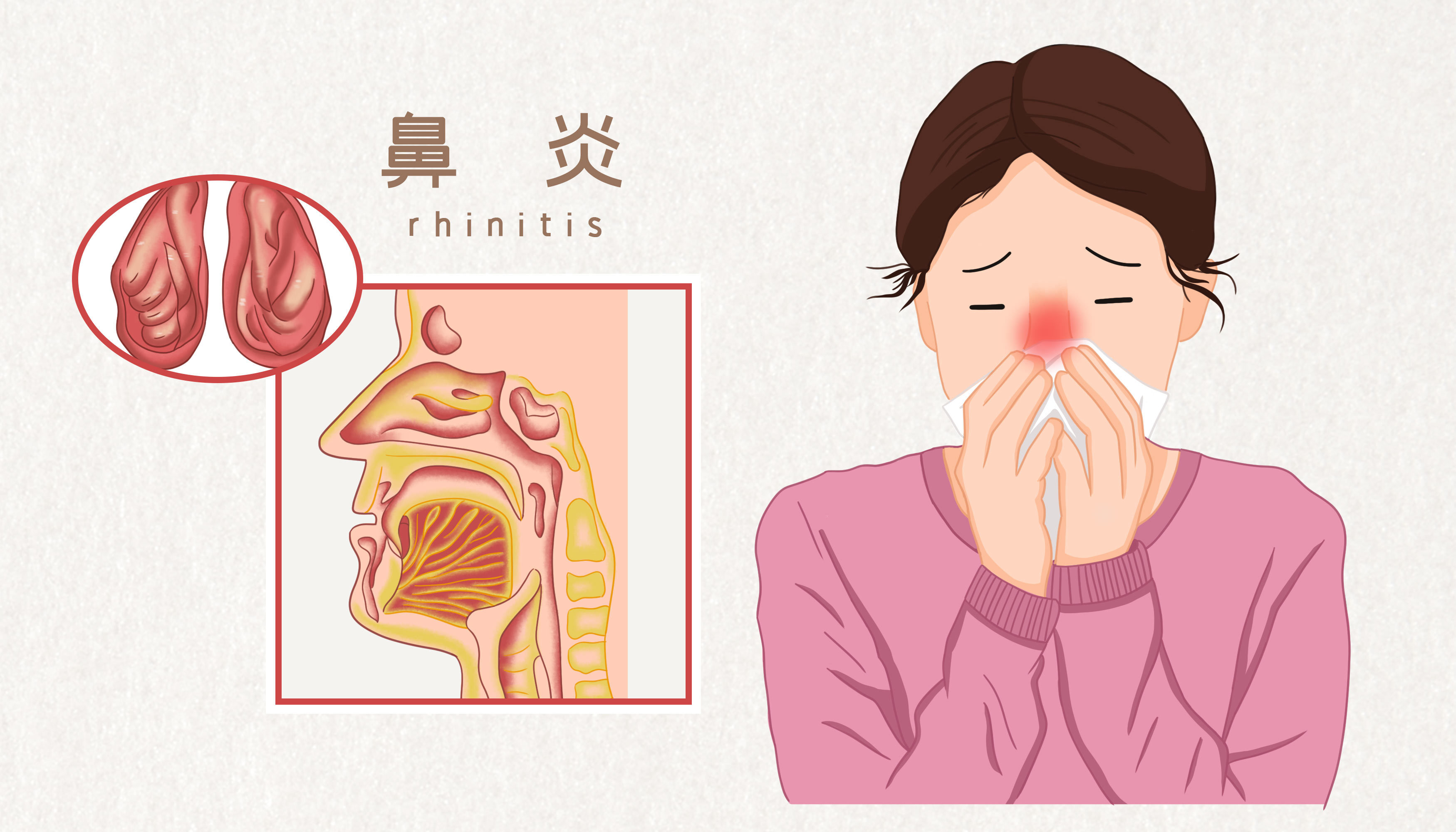 鼻窦炎患者可能表现的的不适症状有哪些?-京东健康
